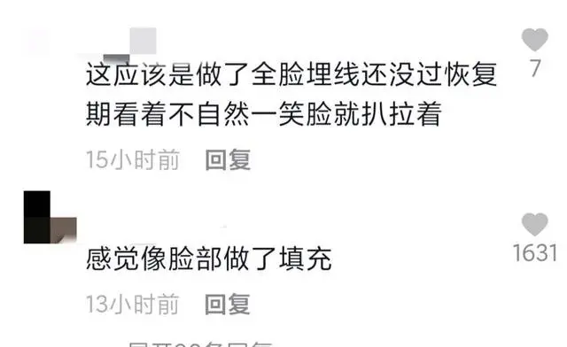 发福发腮、满脸褶子、肿胀僵硬还秃顶…港圈男神其实都是虚假冻龄