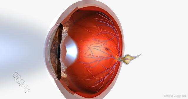 视网膜各层出血的原因，科普下