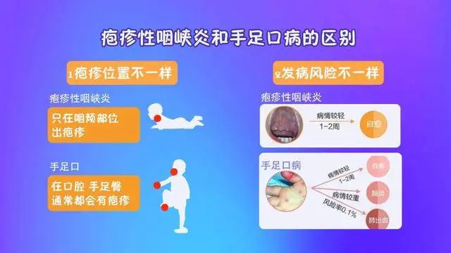 咽喉肿痛，咽干不适？专家：或与3种疾病有关，别不当回事