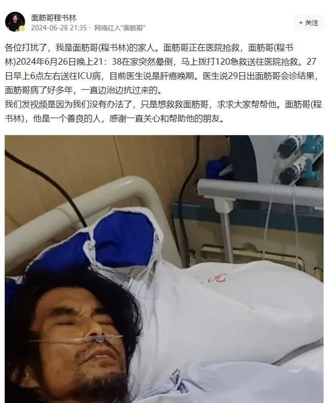 网红“面筋哥”肝癌晚期送ICU