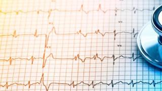 心电图有多厉害？这4类心脏疾病它都知道，疾病没法逃