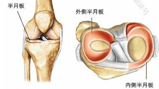 膝盖不定时疼痛，检查不出问题？一文了解下