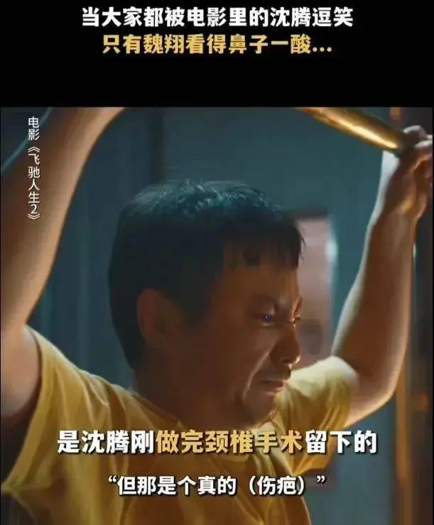 沈腾手术后遗症明显，长伤疤惊悚吓人，不卖惨的他让多少人脸红？