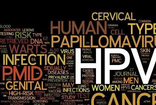 感染“HPV”后，若有3种变化，可能是“它”的敲门砖，最好别忽视