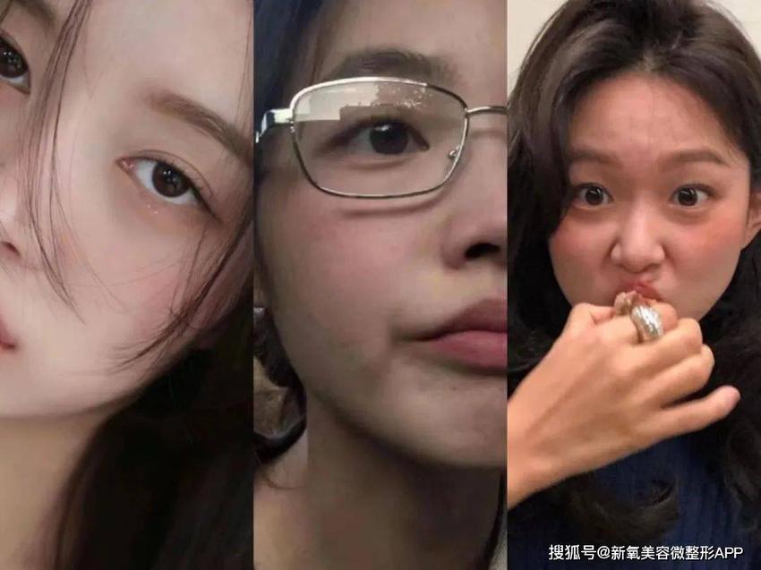 这次向太郭碧婷的豪门纠葛，还没有她掉到嘴角的黑眼圈精彩…