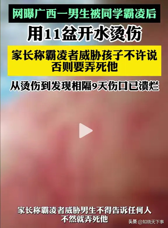 男孩被同学泼11盆开水，受威胁不敢吭声，父亲急了，知情人爆原因