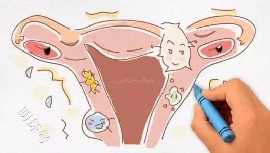 昆明送子鸟：子宫息肉是怎么引起的？对怀孕有什么影响？