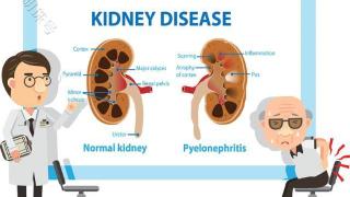 急性肾炎会转变成慢性肾炎吗？这两者有什么区别，分析下