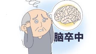 什么是脑卒中？脑卒中有预兆吗？