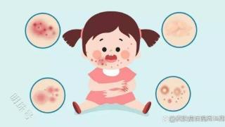 干货篇：特应性皮炎对幼儿有什么影响？了解下