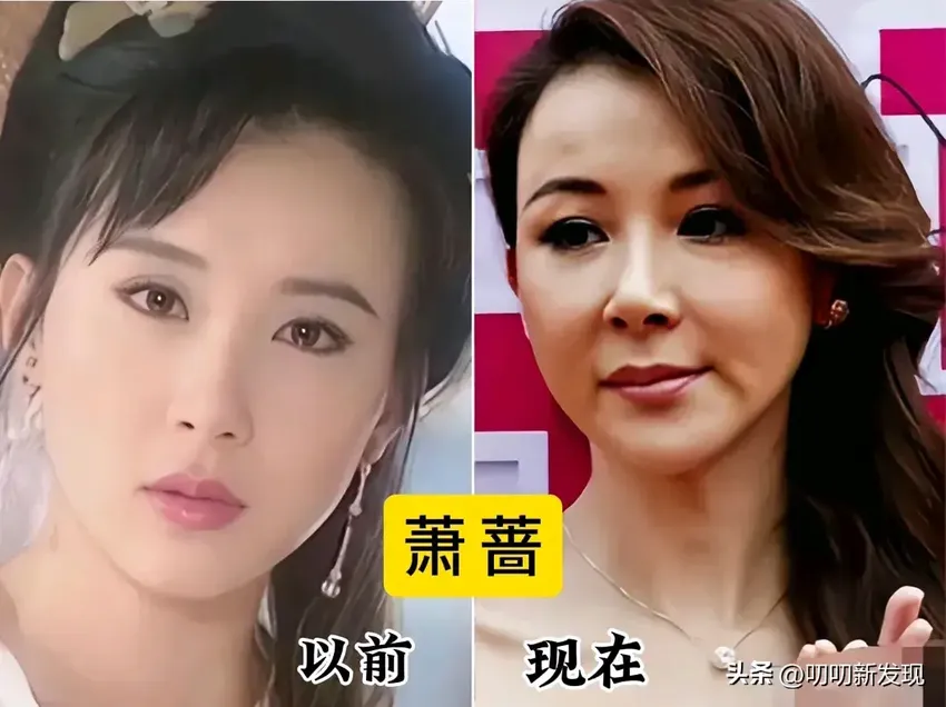 “自毁前程”式的变脸，她们明明长得那么美！却偏偏想不开要整容