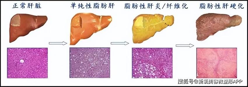 被嘲虎背熊腰胖成200斤的巩俐暴瘦回春了？！生图戴3亿项链太有影后牌面...