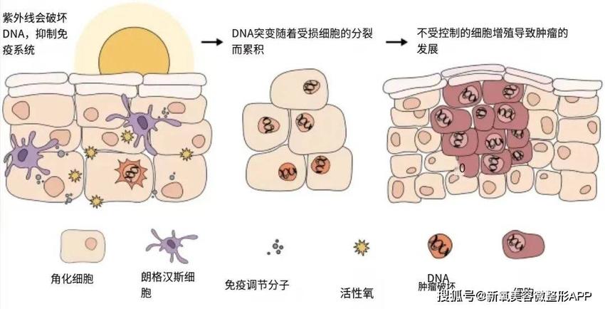 让卡戴珊三姐脸上留大坑差点毁容的痘痘，不管会要人命？