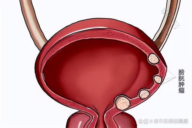 尿常规蛋白、潜血有加号，红细胞升高，分别应该咋应对？参考下