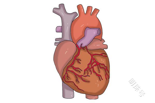 心血管狭窄70%，代表得了心梗？一文揭开疑惑