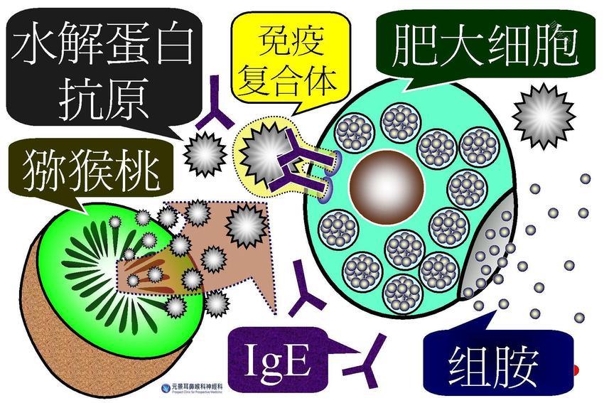 台湾耳鸣眩晕权威提醒：每天头痛当脑瘤，真相竟是食物过敏