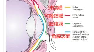 灰尘、睫毛……进到眼睛里的异物 最后都去哪儿了啊