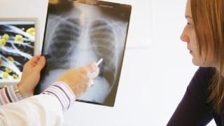 肺开始“癌变”时，身体可能会出现3个“怪象”，尽量别大意！