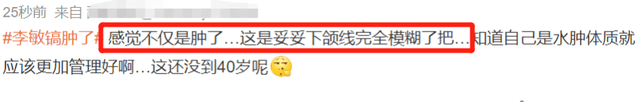 李敏镐最新生图不敢认！脸颊胖到像气球，疑似整容后遗症爆发