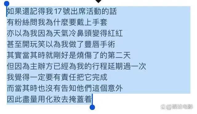 关智斌曝脸和手部二级烧伤，次日坚持活动，胡彦斌霍汶希留言安慰