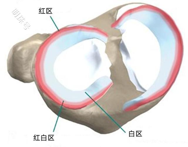 半月板撕裂，该缝合还是该切除，分这几种情况,不妨看看