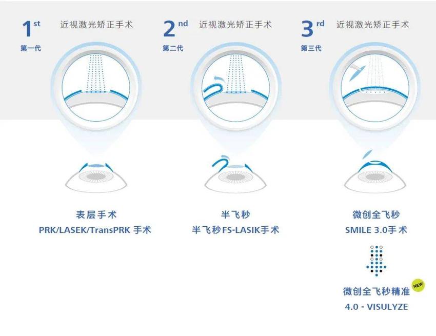 重磅!广州英华眼科全飞秒精准4.0-VISULYZE正式启航!