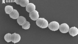 日本爆发“食人菌”感染 死亡率高达30