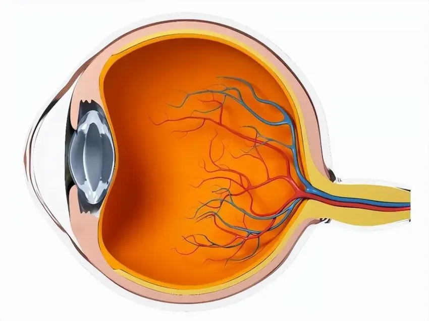 糖尿病视网膜病变怎么回事？注意这些症状，做好早期预防！