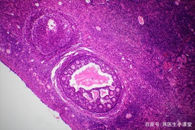 肝囊肿、肾囊肿严重吗？一文揭晓答案