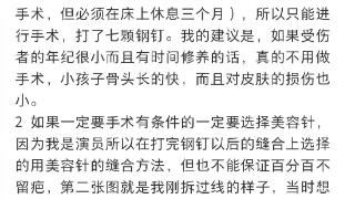 王乐君自曝拍戏时被胡歌砸断锁骨 事后自己找医院手术