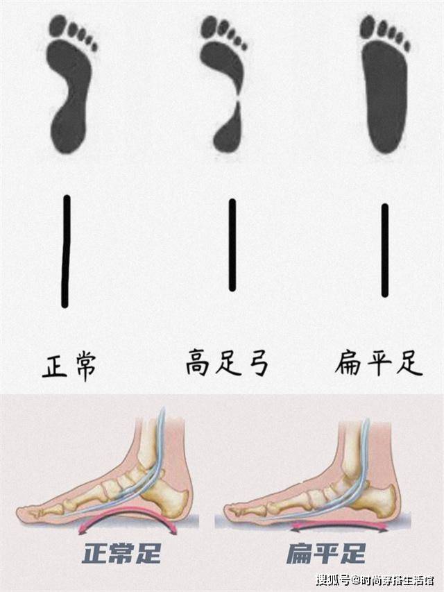 今年夏天除了小白鞋，还可以尝试这3双鞋