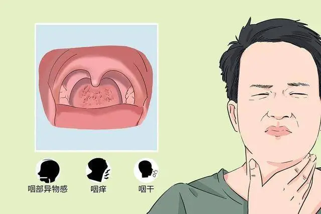 以为是慢性咽炎，去医院却查出食管癌？医生：5点区别要了解