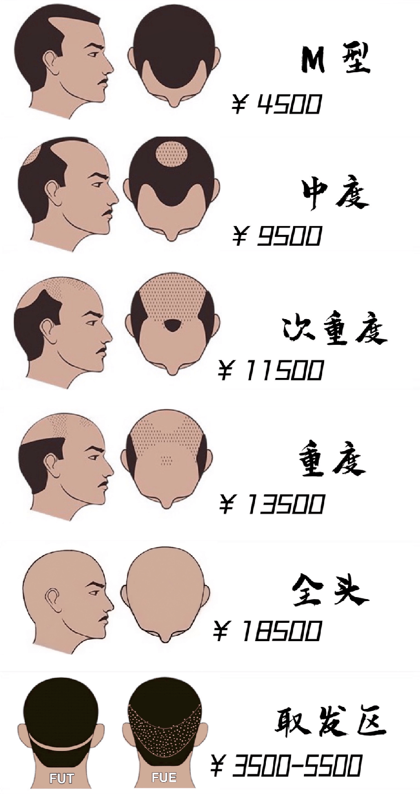 我，秃头，改学纹发后月入10万