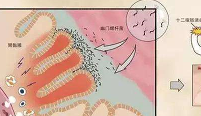 养胃，是一件长期的事，多做3件事，胃会越来越好