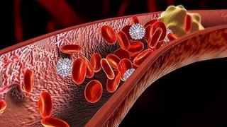 身体有血瘀，常见3种病因，中医用桃红四物汤加减，见效很快