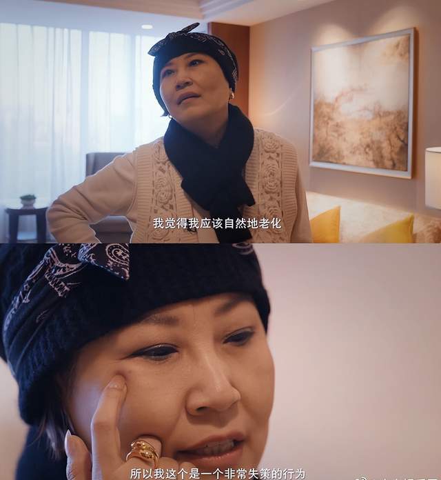 “迪斯科女王”张蔷整容失败，指责医生不认真，大方展示眼袋疤痕