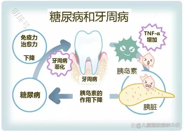 儿童糖尿病并发症的八个信号，出现别不当回事，建议看看