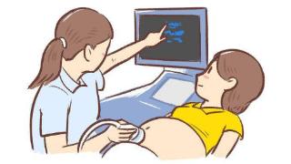 精准解读早孕期超声检查