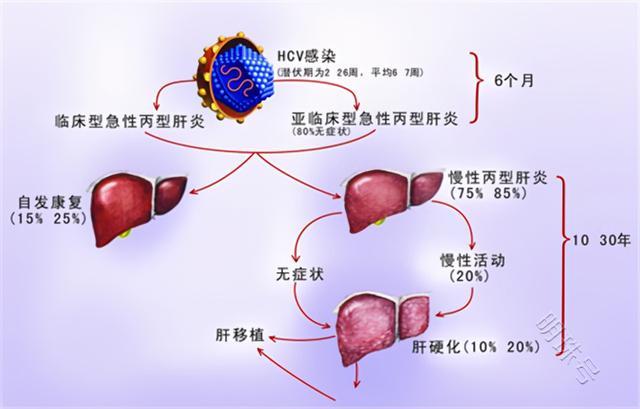 身上若有“一痒二红三痛”的情况，一定要及早做肝癌筛查，别大意