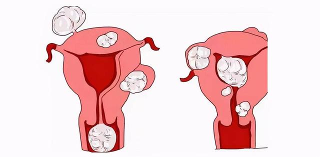 子宫”干净“的女性一般会有这4个表现，自查一下自己占了几个