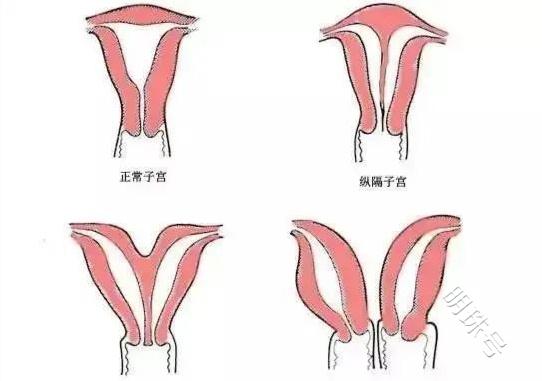 得了【习惯性流产】，还能生出健康宝宝吗？别害怕，一文带你揭秘