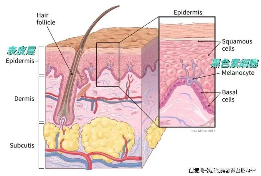 让卡戴珊三姐脸上留大坑差点毁容的痘痘，不管会要人命？