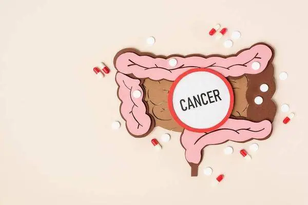 一天3次和三天1次大便，哪个是肠癌？这5个异常才是它的早期信号