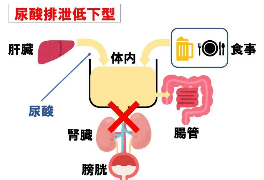 痛风肾，尿酸排泄障碍，应该怎么调？痛风专家黄川云支招！