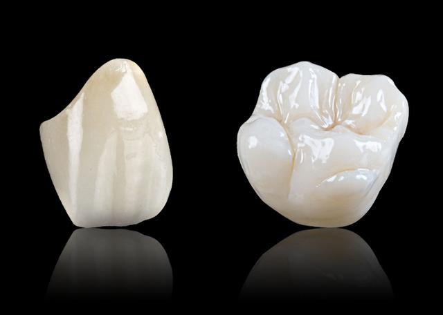 金属牙、烤瓷牙和全瓷牙哪个更好？牙医为啥大多都推荐全瓷牙？