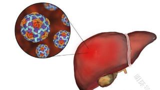 乙肝五项检查能救命！乙肝患者这样保护肝脏，学习下