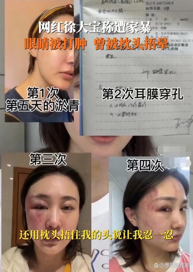 女演员遭家暴一年后终离婚！男方从小就练散打，被判净身出户