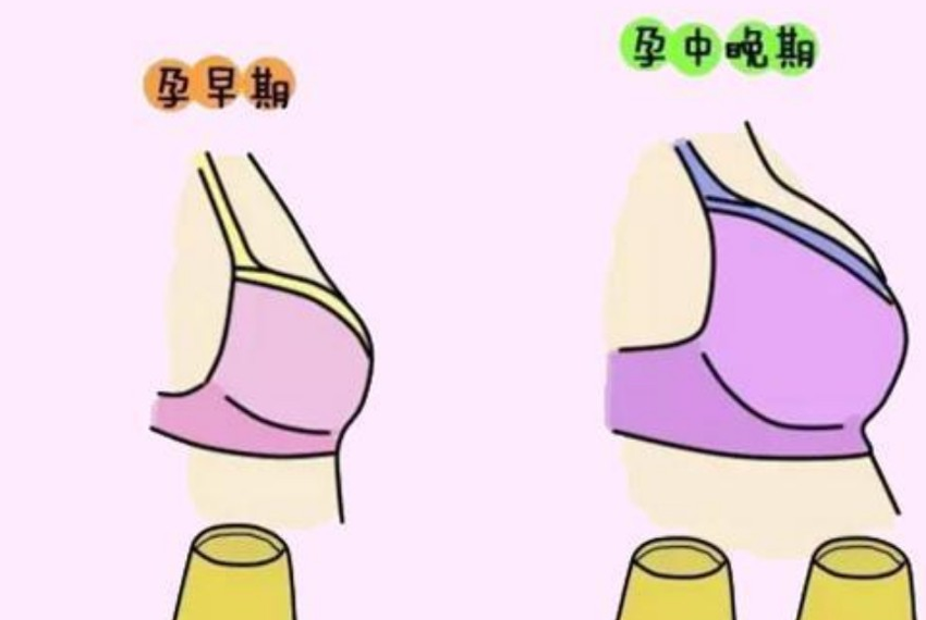 孕期乳房疼痛可采用哪3种护理方法