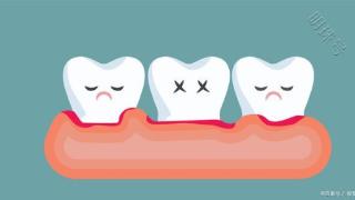 肾虚是引起牙齿松动的主要原因，中医调理注意这三点
