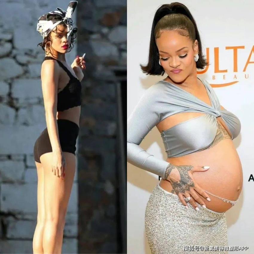 蕾哈娜怀孕6-7个月？无缝衔接怀孕不伤身体，你怎么看？